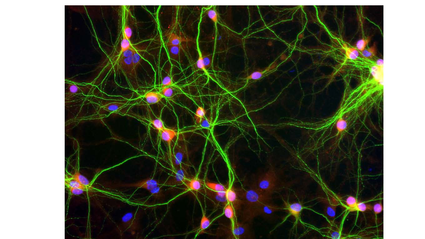 a picture of neurons